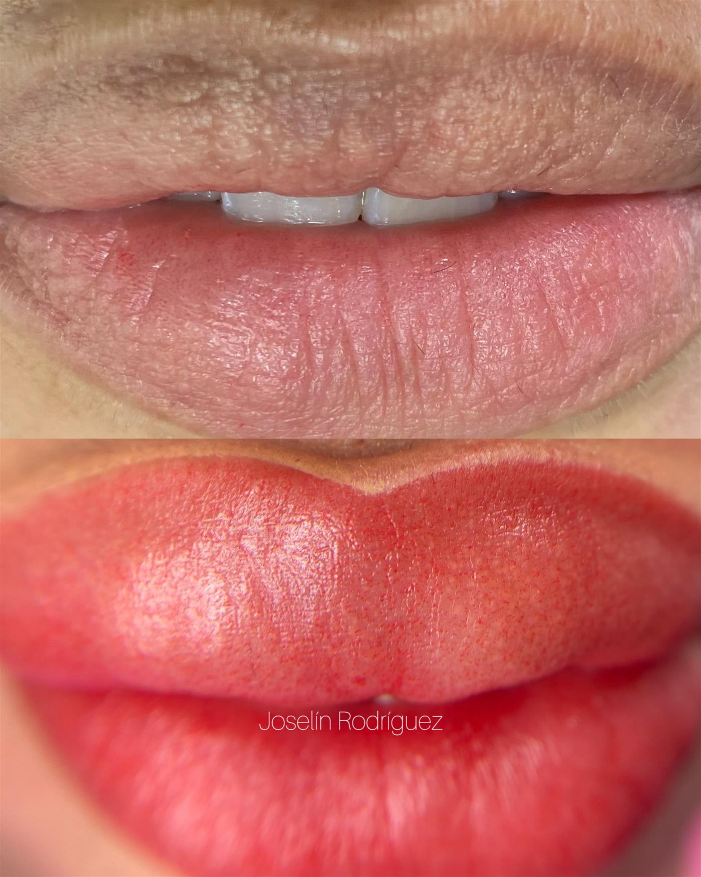 Labios antes y después de la micropigmentación