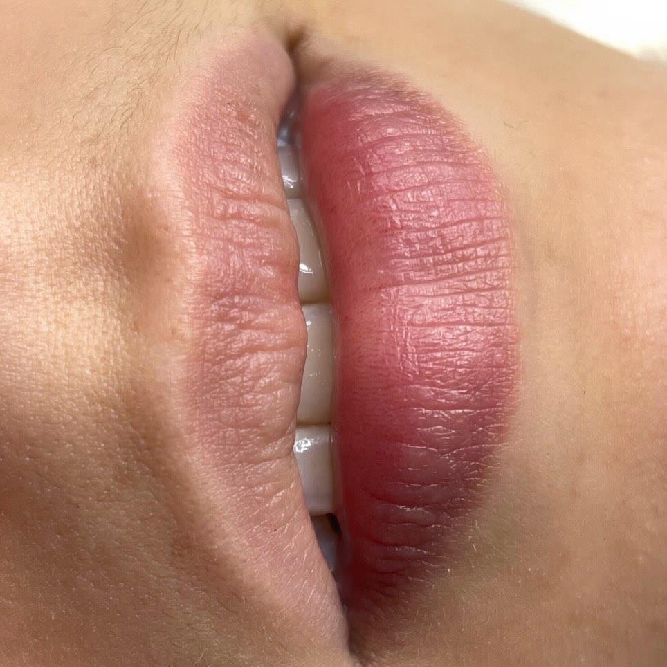 Perfil de labios micropigmentados